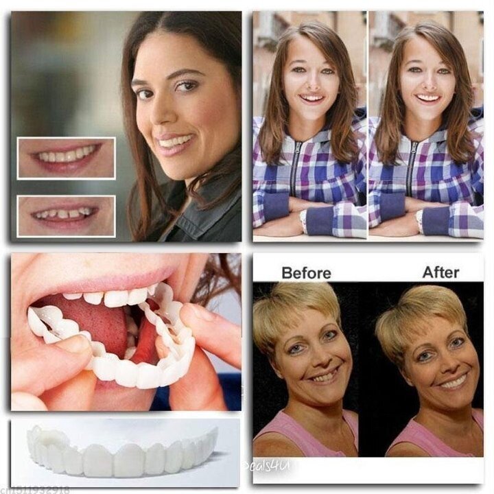 💝Last-day discount-75%Off💝⭐Latest⭐👨‍⚕Adjustable Snap-On Dentures😁
